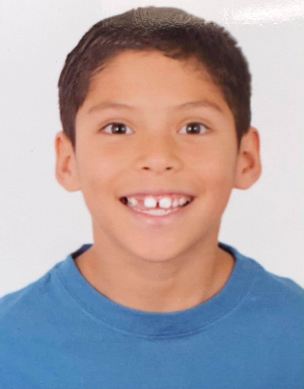 IGNACIO